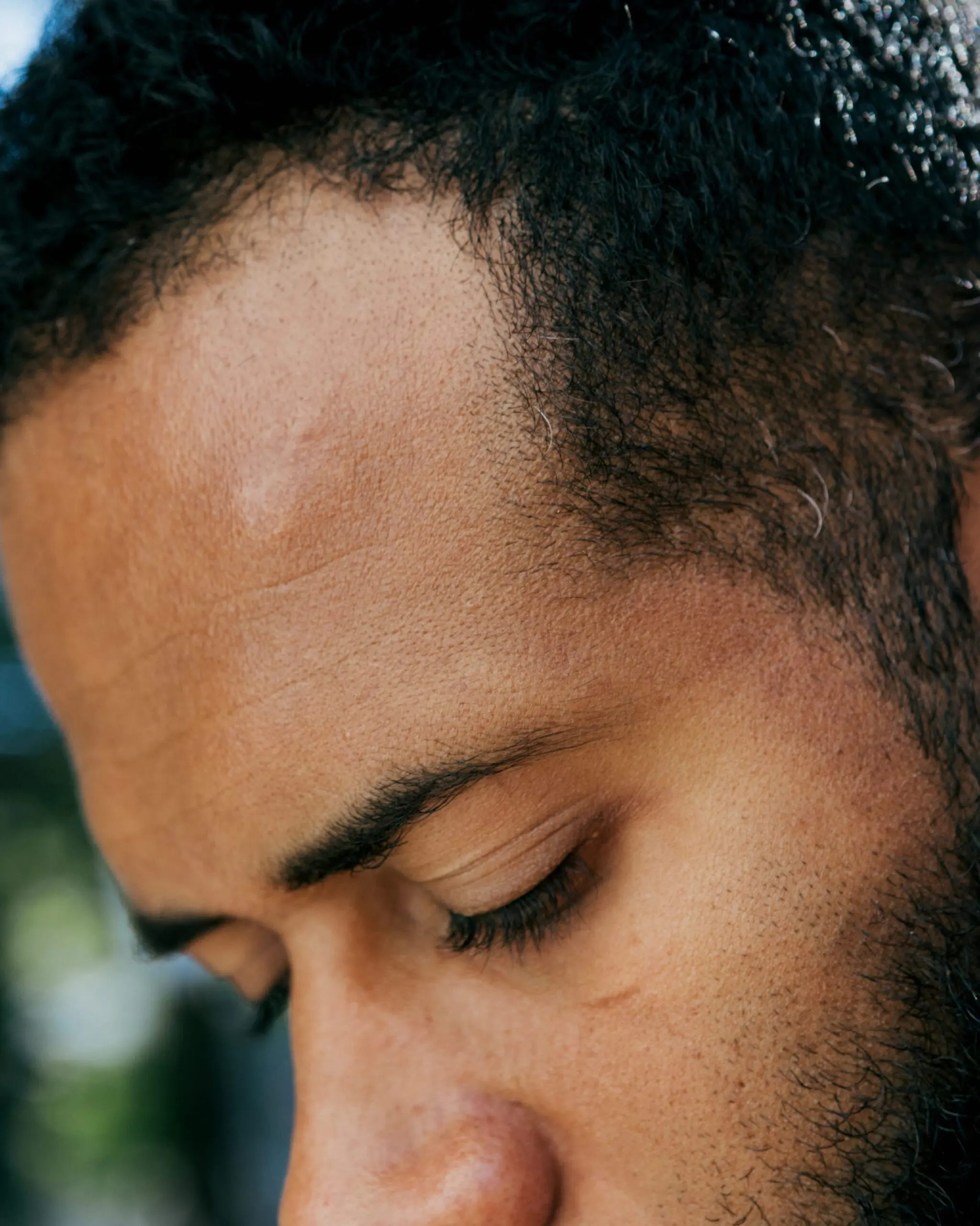 Andre Miller looks down, revealing the scar on his forehead.